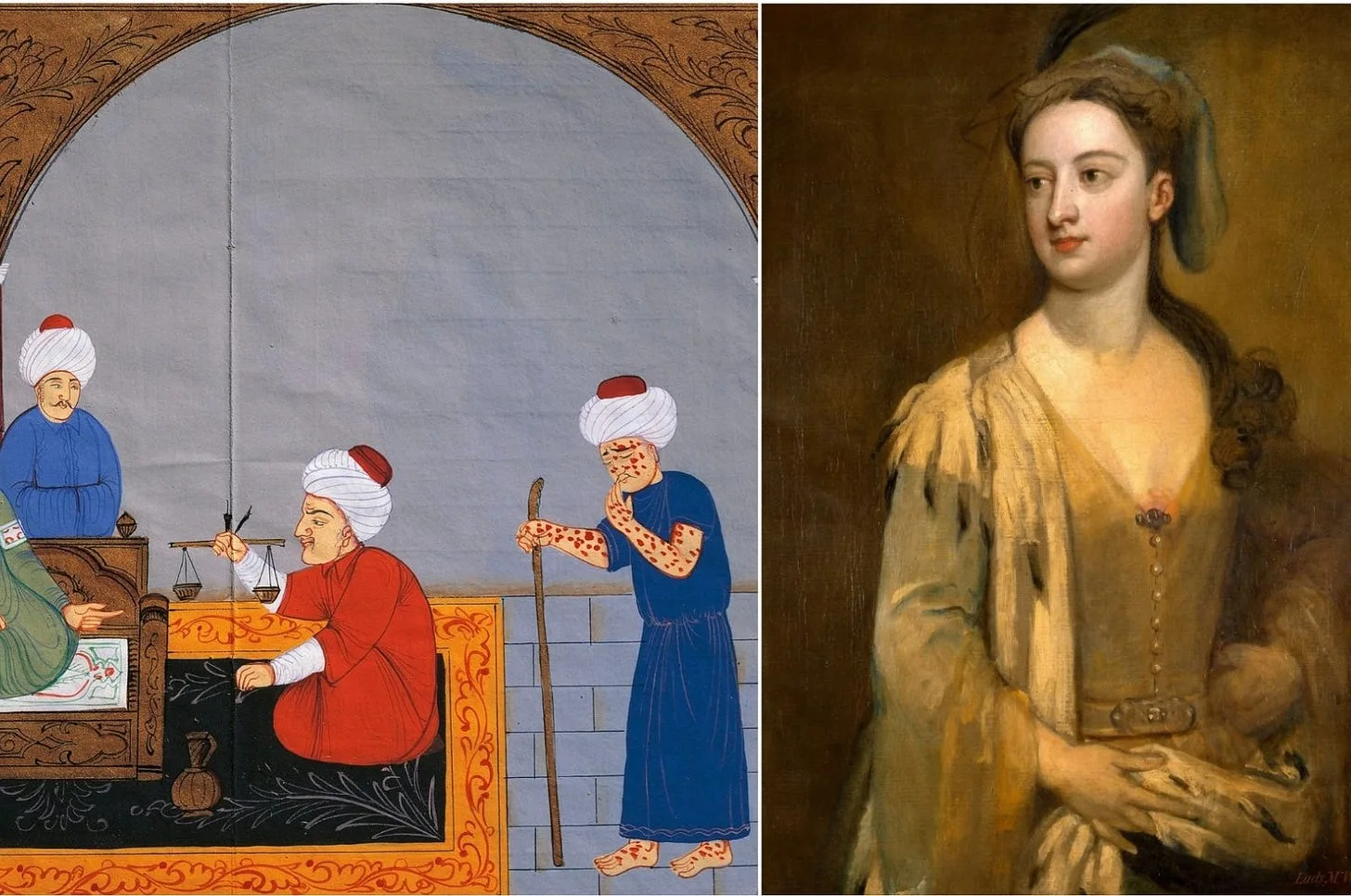Sultan's Harem, Lady Montague, Milkmaids: The Fascinating History of Vaccination