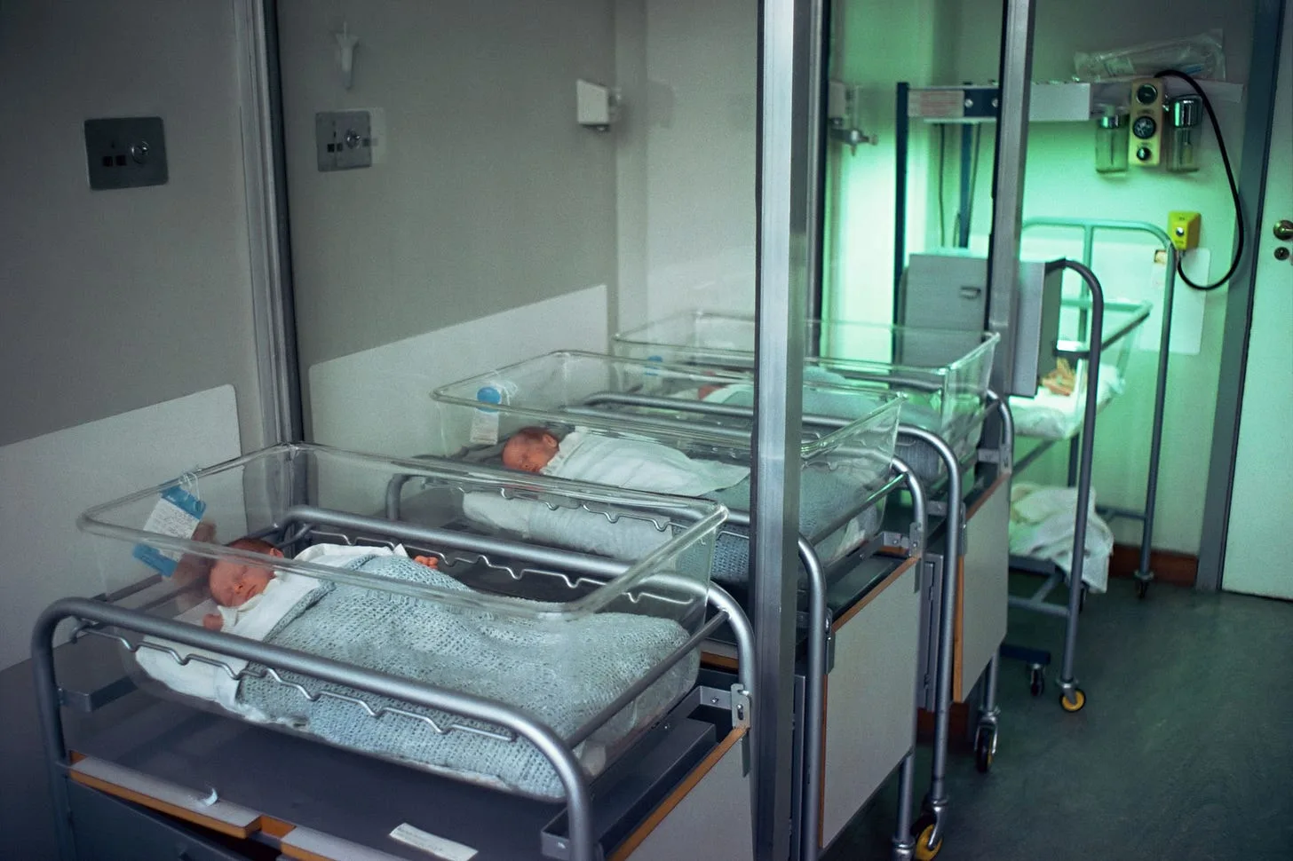 The Jaundice Epidemic at Modern Maternity Units