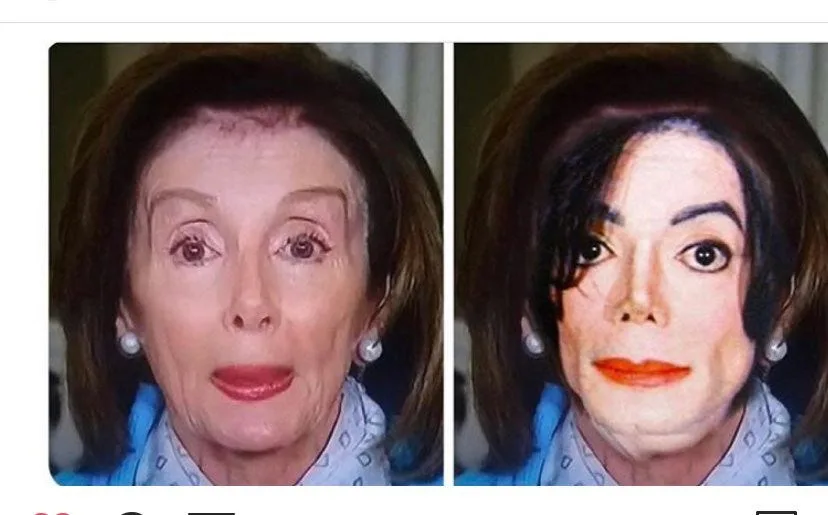 Is it Worth it? What Happens in the Body after Botox?