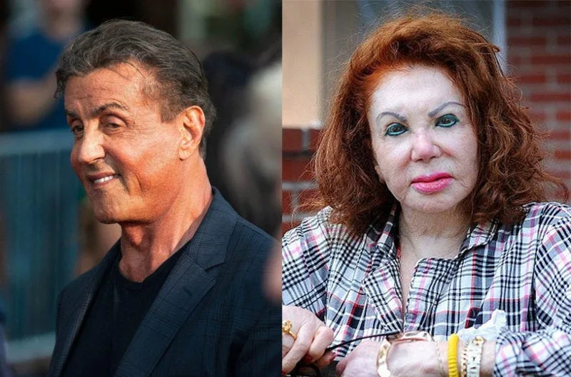 Actor Sylvester Stallone (left) and his mother Jackie after facial surgeries