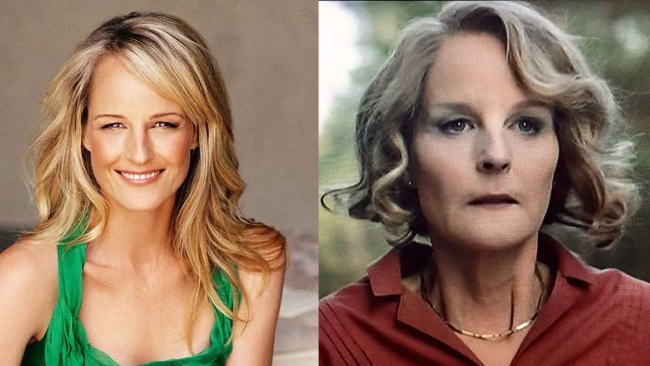 Actress Helen Hunt Before and After Botox