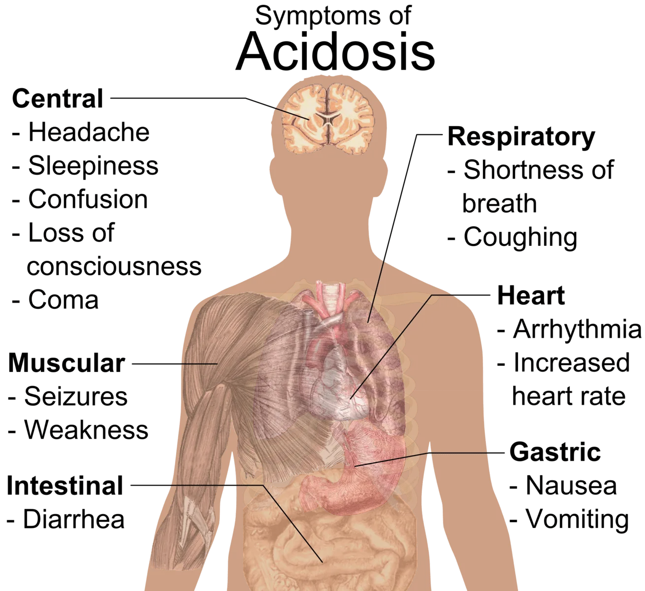 The Serious Risks Associated with Metformin and Ozempic