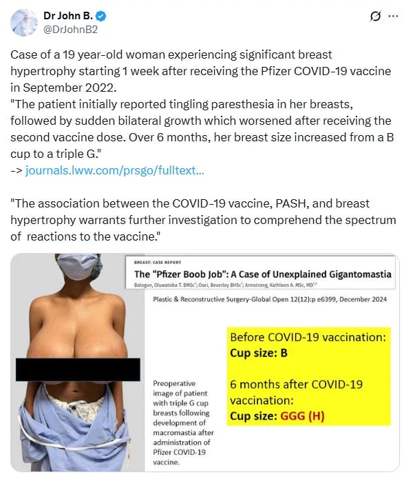 Gigantomastia and C-Sections: Gender-Specific Effects of COVID Shots on Women