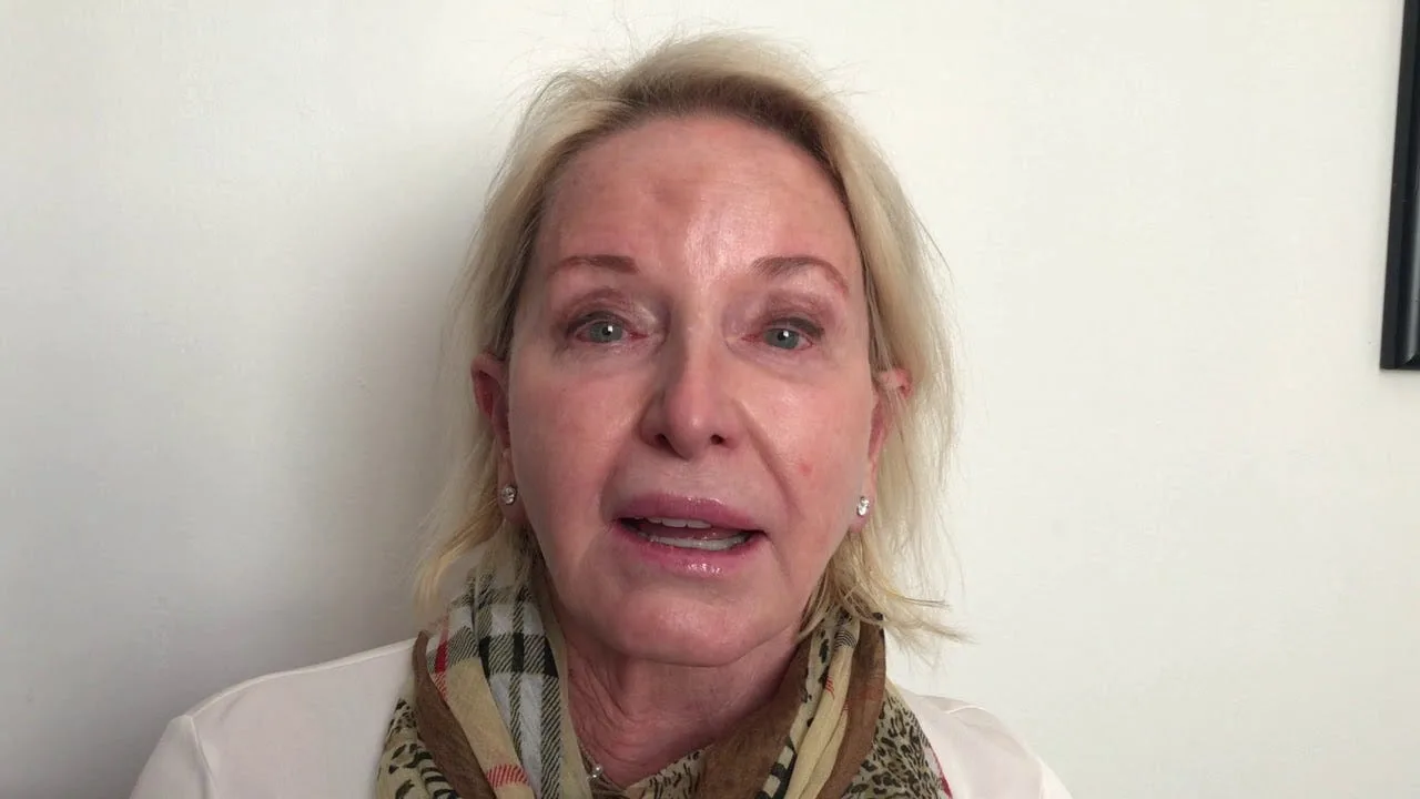 Dr. Carruthers, the pioneer of Cosmetic Botox in the world